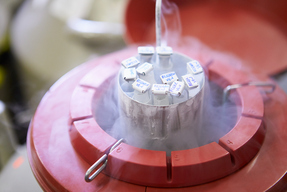 Fertility specialist explaining egg, sperm, and embryo freezing to a couple considering future parenthood.