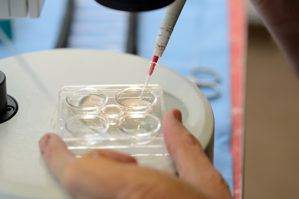 Laboratory process of preparing embryos for IVF treatment using advanced techniques.