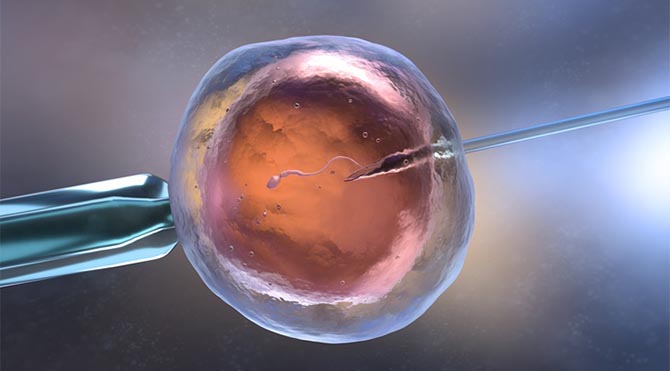 Illustration of PICSI procedure showing sperm injection into egg during advanced fertility treatment.