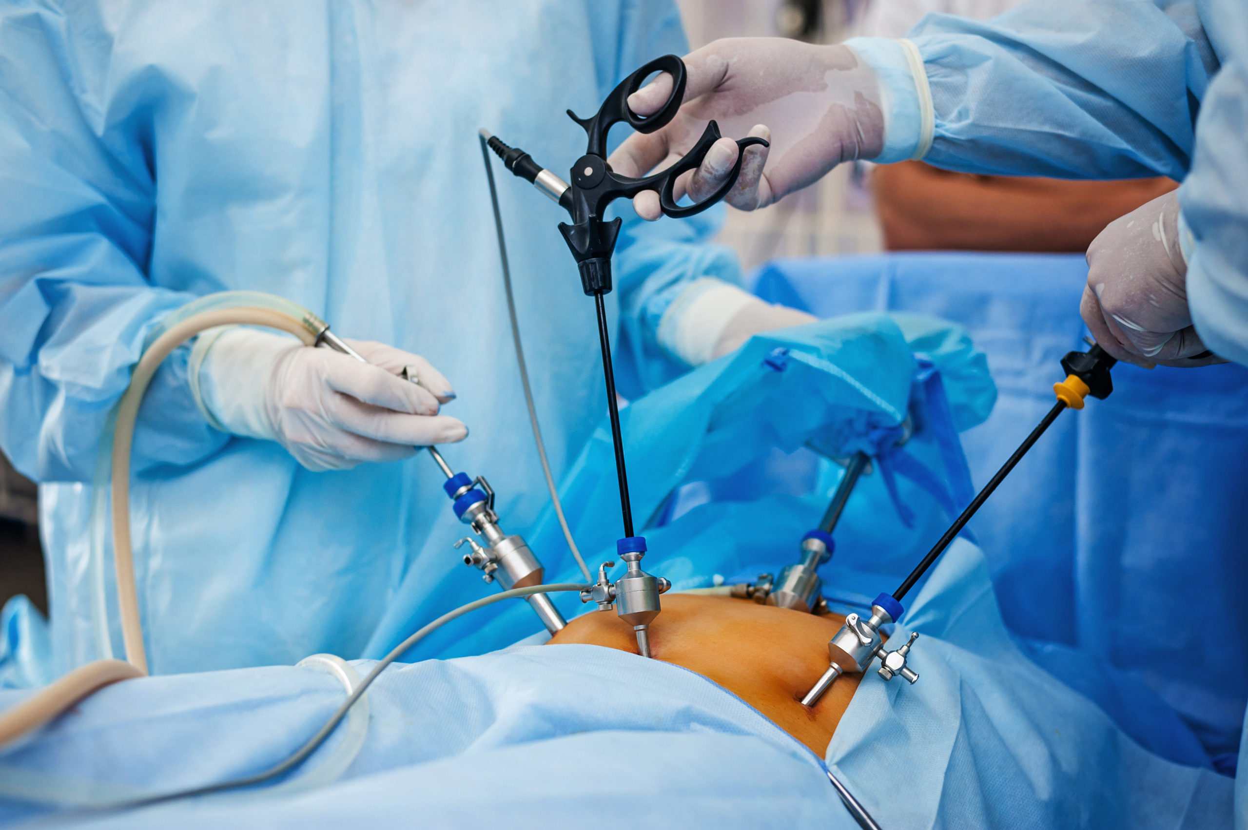 Gynecologist performing laparoscopy using minimally invasive instruments for fertility treatment.
