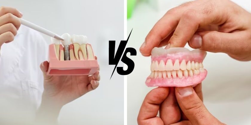 Dental implant replacing a missing tooth with titanium post and crown at Craft32 Dental Care Pune