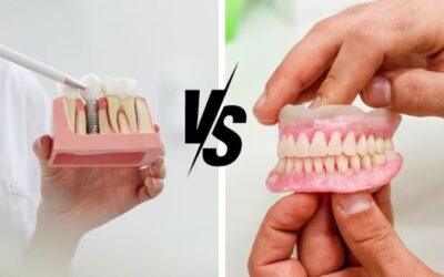 Illustration comparing dental implants, dental bridges, and dentures for replacing missing teeth