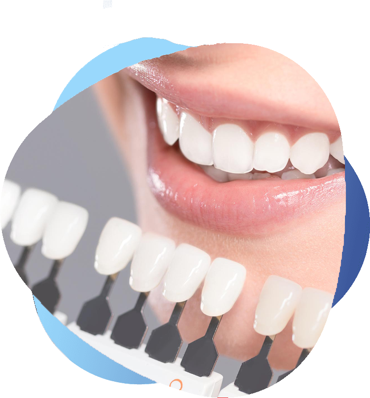 Dentist showing cosmetic dental results with bright white teeth after procedures like teeth whitening, veneers, and dental bonding.